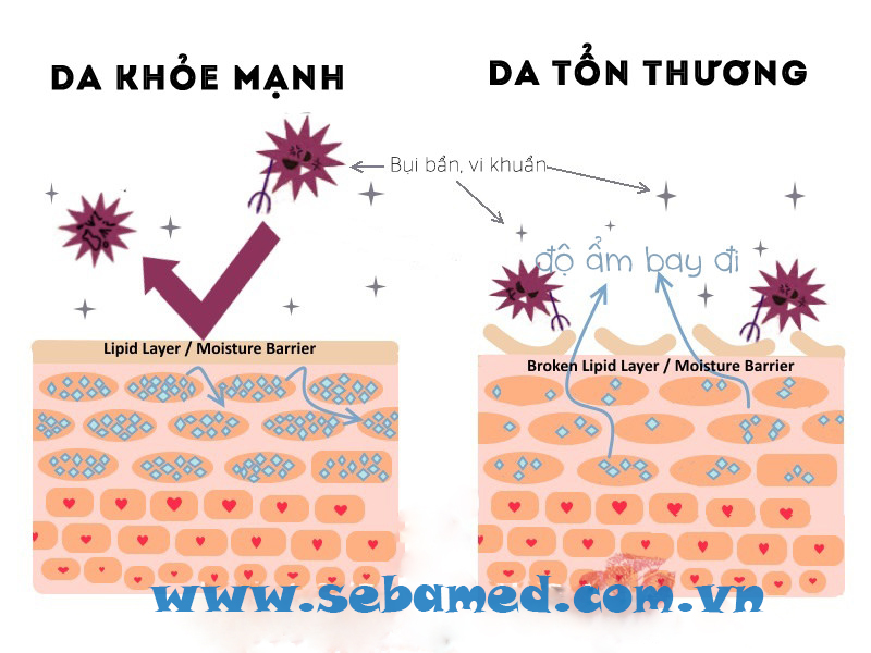 màng acids, bảo vệ da, độ pH, pH 5.5 Chăm sóc da mụn hiệu quả – www.sebamed.com.vn