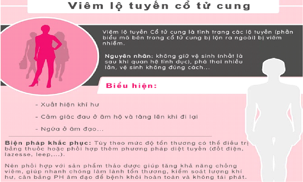dung-dich-ve-sinh-phu-nu-sebamed-1