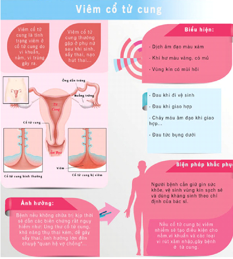 dung-dich-ve-sinh-phu-nu-sebamed-3