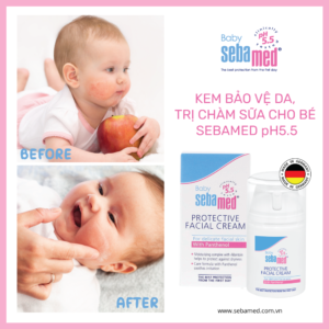 Viêm Da Cơ Địa, Chàm Sữa, Viêm Da Tiếp Xúc 3 - 5 Kem Dưỡng Ẩm Chàm Sữa Cho Bé Sebamed pH5.5 (50ml)