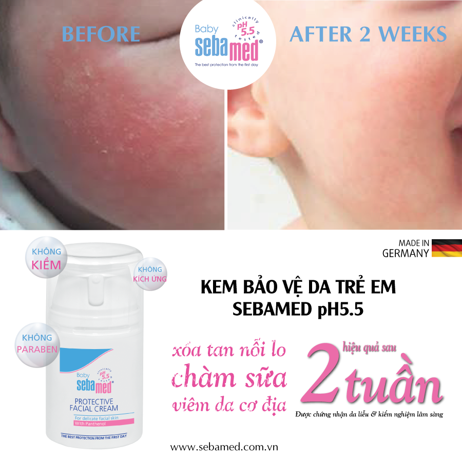 before after kem bao ve da em be sebamed pH5 5 - 3 - Sebamed