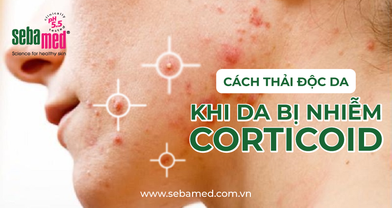 Da nhiễm corticoid