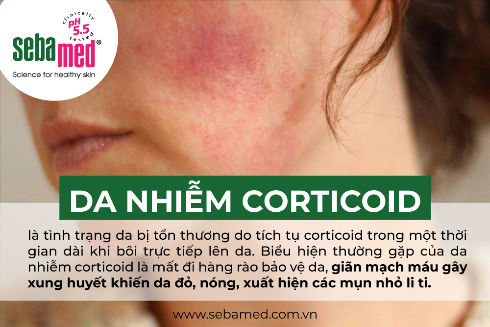 Quy trình chăm sóc da nhiễm Corticoid 1 - 1 Da nhiễm Corticoid