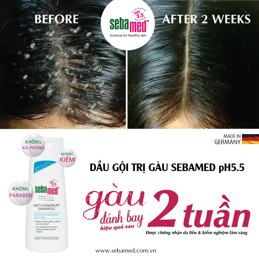 before after dau goi tri gau sebamed pH5 5 1 - 5 - Sebamed