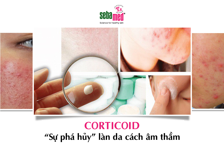 corticoid su pha huy lan da am tham - 5 - Sebamed