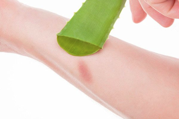 Chiết xuất lô hội Aloe Vera trong mỹ phẩm có tác dụng gì cho da? 4 - 6 Gel nha đam giúp làm dịu vết bỏng và phục hồi hàng rào bảo vệ da