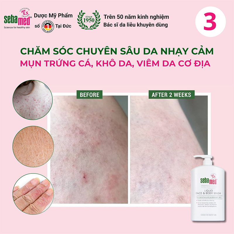 Sữa rửa mặt & tắm toàn thân Sebamed: Bí mật da khỏe từ Đức 11 - 12 Sử dụng Sữa rửa mặt và sữa tắm toàn thân giúp da mềm mịn, phù hợp với da kích ứng, nhạy cảm.