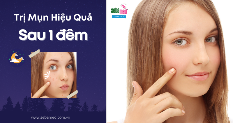 2 - 11 - Sebamed