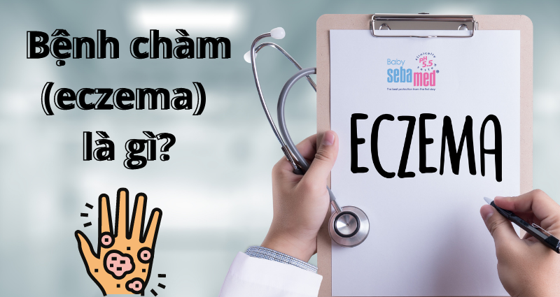 6 - 1 - Sebamed